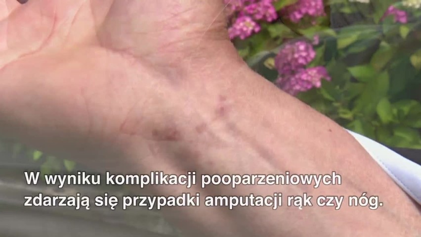 Barszcz Sosnowskiego to jedna z najbardziej toksycznych roślin w Polsce. Jest wszędzie i jest śmiertelnie groźny WIDEO + ZDJĘCIA