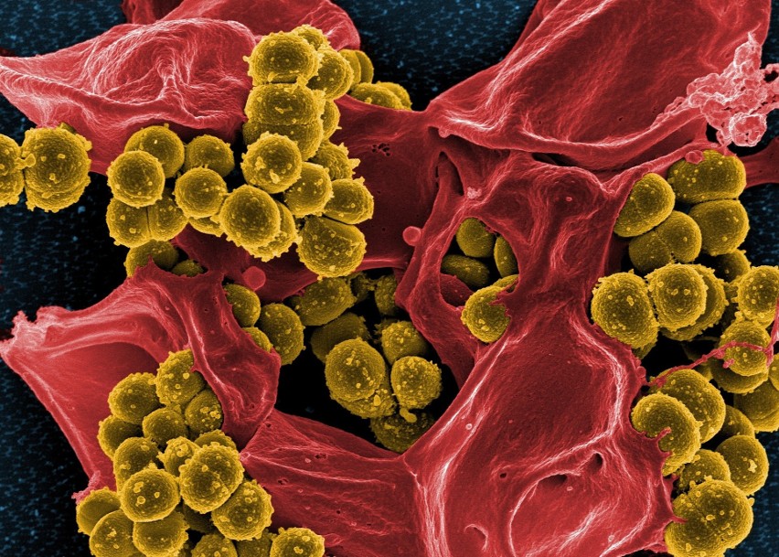 Bakterie kałowe Enterococcus faecium zamieszkują układ...