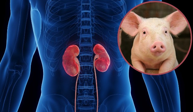 Modyfikacja genetyczna świni polegała na wprowadzeniu do organizmu zwierzęcia ludzkich genów decydujących o tzw. zgodności tkankowej.