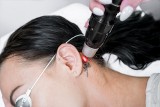 Jakie efekty daje laserowe usuwanie tatuażu i ile kosztuje? Poznaj ceny zabiegów. Czy da się całkowicie usunąć tatuaż i makijaż permanentny?