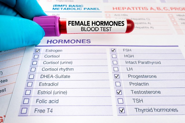 FSH to hormon produkowany przez przysadkę, który pobudza jajniki do produkcji estrogenów. Gdy spada poziom estrogenów, przysadka, chcąc pobudzić jajniki, wytwarza więcej FSH. Dlatego, u kobiety w trakcie menopauzy poziom FSH w moczu będzie podwyższony