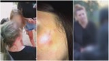 Uwaga! TVN: Kolejna dziewczynka pobita przez gang nastolatek
