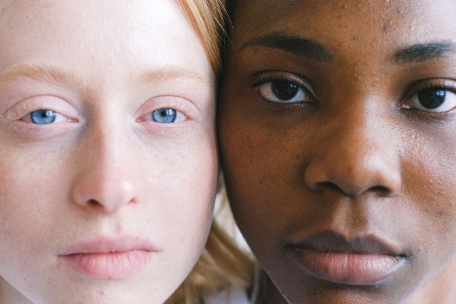Kto jest bardziej podatny na rozwój raka skóry – osoby o jasnych czy ciemnych oczach?