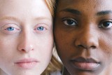 Jaki kolor oczu może zwiększać ryzyko rozwoju nowotworu? Osoby o takich tęczówkach są bardziej narażone na wystąpienie raka skóry