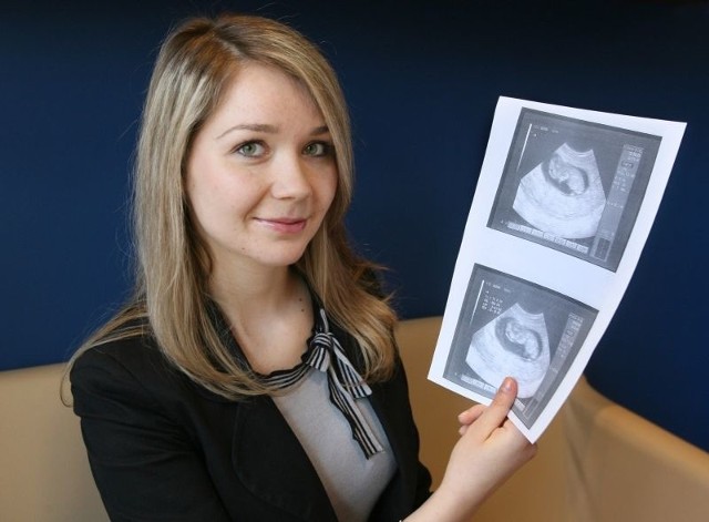 - Od początku ciąży kobieta powinna być otoczona opieką lekarza. Nie dla pieniędzy z "becikowego&#8221;, ale dla zdrowia swojego i dziecka - przekonuje Monika Gubernat, w 10. tygodniu ciąży.