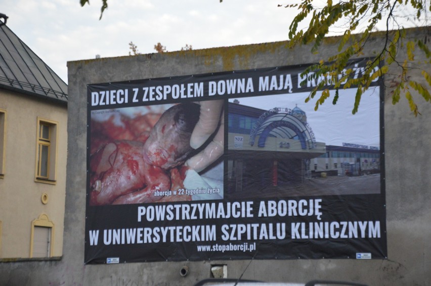 Zdjęcia zakrwawionych płodów pojawiają się we Wrocławiu. Legalnie?