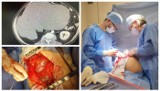 Lekarze z Kędzierzyna-Koźla usunęli pacjentowi 12-kilogramowego guza. To jednak niejedyny sukces tego szpitala. Zdjęcia nie dla wrażliwych