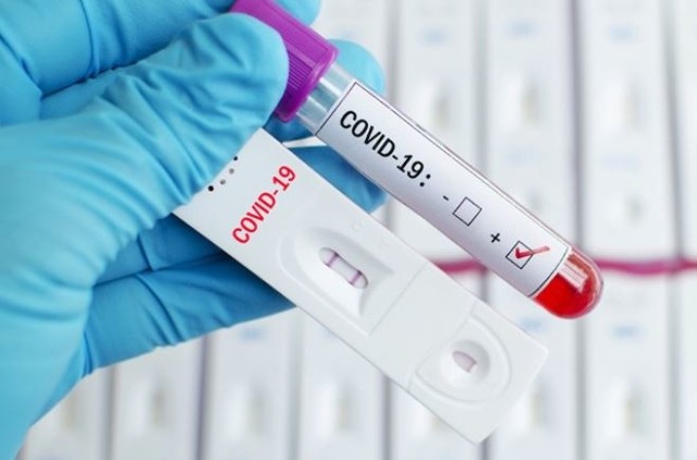 Kolejne sieci handlowe wprowadzają do sprzedaży testy na obecność  przeciwciał wirusa COVID-19.