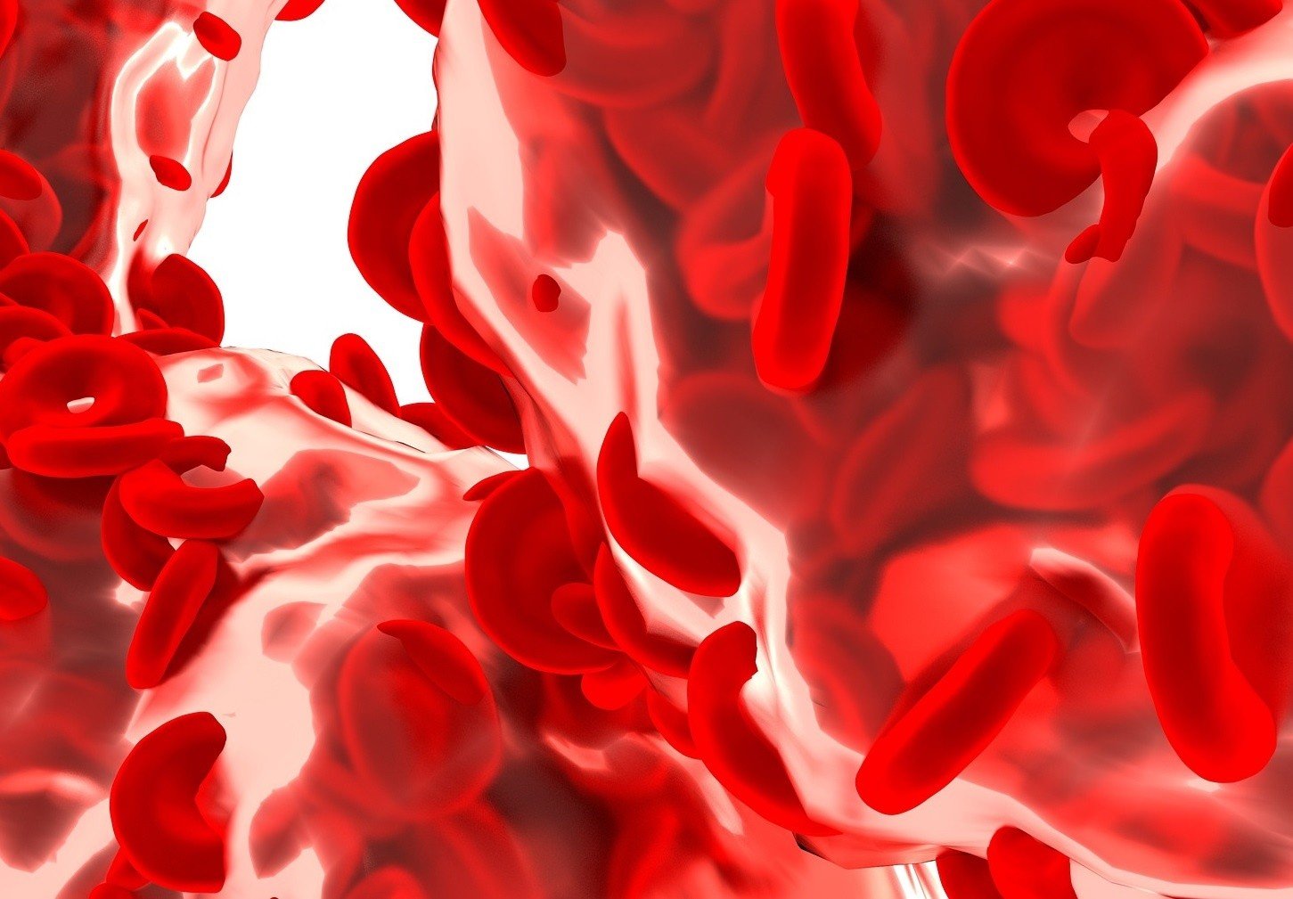 Hemoglobina – co oznacza jej podwyższony poziom, a co obniżony? Wysoka i niska  hemoglobina: normy dla dorosłych, dzieci i w ciąży | Strona Zdrowia