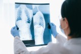 Lubuskie: pulmonolog w regionie godny polecenia? Mamy dla ciebie ranking stworzony na podstawie opinii pacjentów