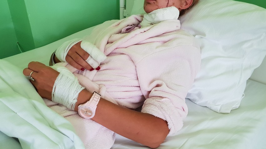 Pani Katarzyna trafiła do szpitala w Strzelcach Opolskich.