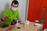 Grzegorz z Iwonicza-Zdroju stracił rękę w wypadku. Marzy o specjalistycznej protezie. Możemy mu pomóc