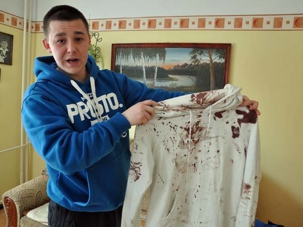 Szymon Gomoła pokazuje bluzę, którą pobrudziła krew z rany na rozbitej głowie po szarpaninie z policjantem.