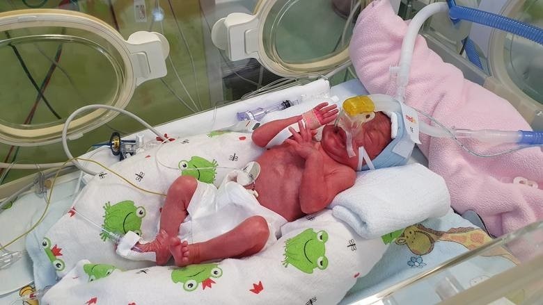 Pięcioraczki z Gniezna urodzone w szpitalu na Polnej dostaną duże wsparcie finansowe
