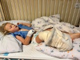 3-letni Kubuś z Odrzechowej przeszedł już 5. operację nóżki! Potrzebuje naszego wsparcia w powrocie do zdrowia