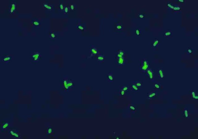Fluoryzyjące komórki bakterii Legionella pneumophila wyznakowanych przeciwciałami