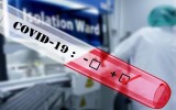 W poniedziałek 19 kwietnia Ministerstwo Zdrowia informuje: Zmarły 3 osoby ze Świętokrzyskiego zakażone koronawirusem