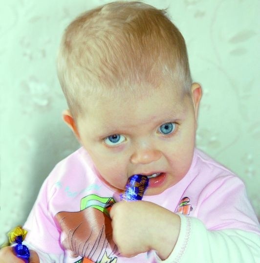 Niespełna dwuletnia Zuzia Cimaszewska wiele już wycierpiała. - To pogodne dziecko, gdy tylko nic jej nie boli - mówią rodzice.