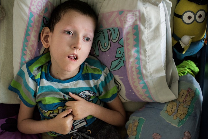 Pięcioosobowa rodzina mieszka na 39 m.kw. Ciężko chory 11-letni Hubert marzy o własnym pokoju