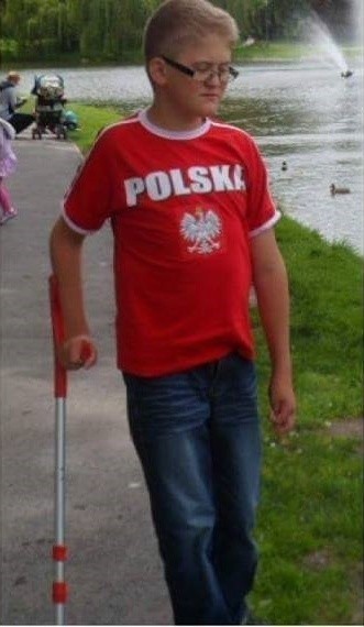 16-letni Kamil Wołczyk z Wojciechowic walczy ze stożkiem rogówki i pilnie potrzebuje operacji wzroku. Pomóżmy mu w walce z chorobą 