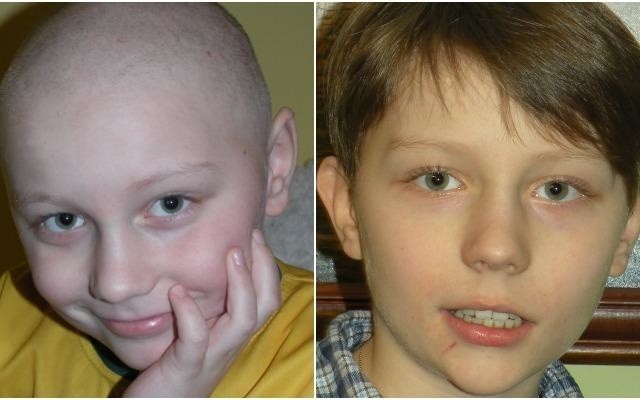 Damian Ługowski z Bytomia ma 12 lat z złośliwego guza mózgu. Operacja to jego ostatnia szansa, a czasu jest niewiele