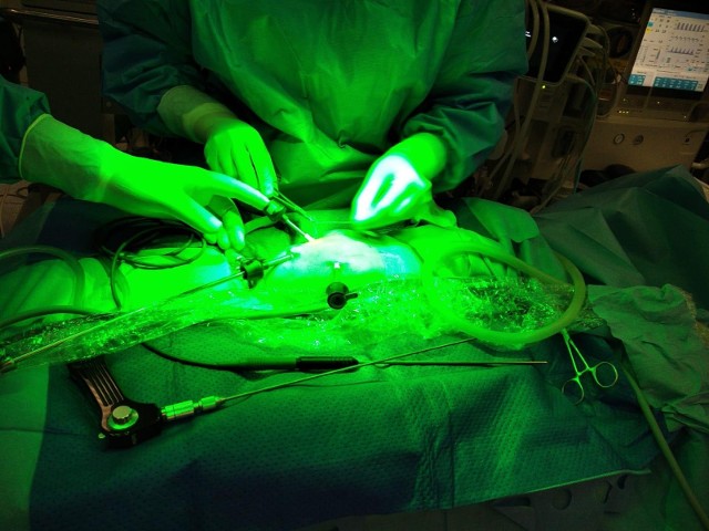 Nowy aparat powoduje, że narządy pacjenta, który leży na stole operacyjnym, na ekranie widoczne są jako „świecące” na zielono, co ułatwia chirurgom wykonanie operacji.