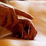 Dentysta: Akupunktura przed borowaniem