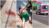 Podhale: Szaleniec atakował ludzi tłuczkiem do mięsa na ulicy. Są ranni! [ZDJĘCIA 18+]