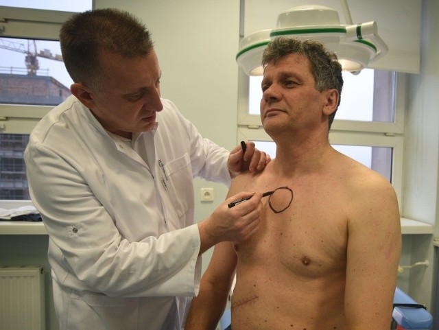 Dr Sławomir Jabłoński pokazuje, gdzie będzie umieszczony implant mostka. Nz. 52-letni Andrzej Bawolak