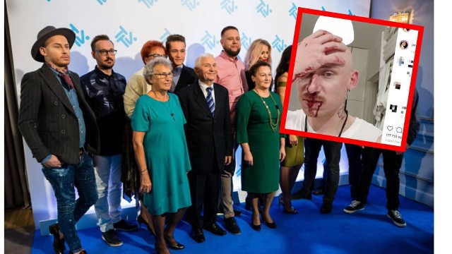 Jacek Szawioła z programu "Gogglebox" został pobity. O tym przykrym zajściu poinformował na Instagramie. Pokazał jak wygląda jego twarz po tym zdarzeniu.ZOBACZ ZDJĘCIA I FILMY - KLIKNIJ DALEJ
