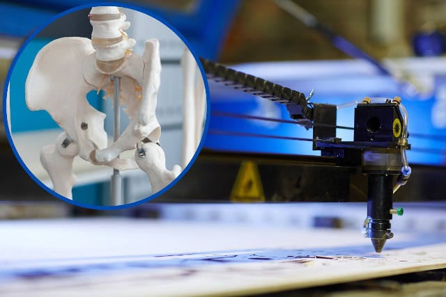 Model 3D miednicy składa się z odtworzonego na drukarce 3D kośćca oraz powłoki imitującej skórę. Umożliwia on planowanie operacji i terapii nowotworów występujących w okolicy ginekologicznej miednicy.