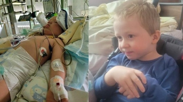 4-letni Filipek z Częstochowy miał wypadek. Bardzo potrzebuje pomocy. W internecie ruszyła zbiórka