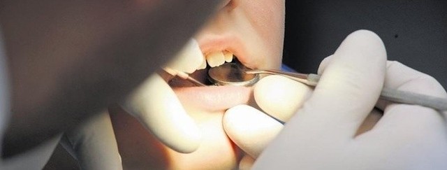 Chora umysłowo dziewczynka ma problemy z zębami. Jednak w jej przypadku nawet rutynowa wizyta u dentysty to kłopot.