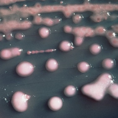 Bakterie klebsiella pneumoniae.