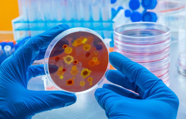 Kolonie drobnoustrojów na szalce petriego. Tak hoduje się bakterie w laboratorium, by np. sprawdzić, czy są obecne w próbce materiału pobranego do badań.