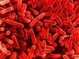 Legionella czai się w rurach instalacji wodnej toruńskiego hospicjum