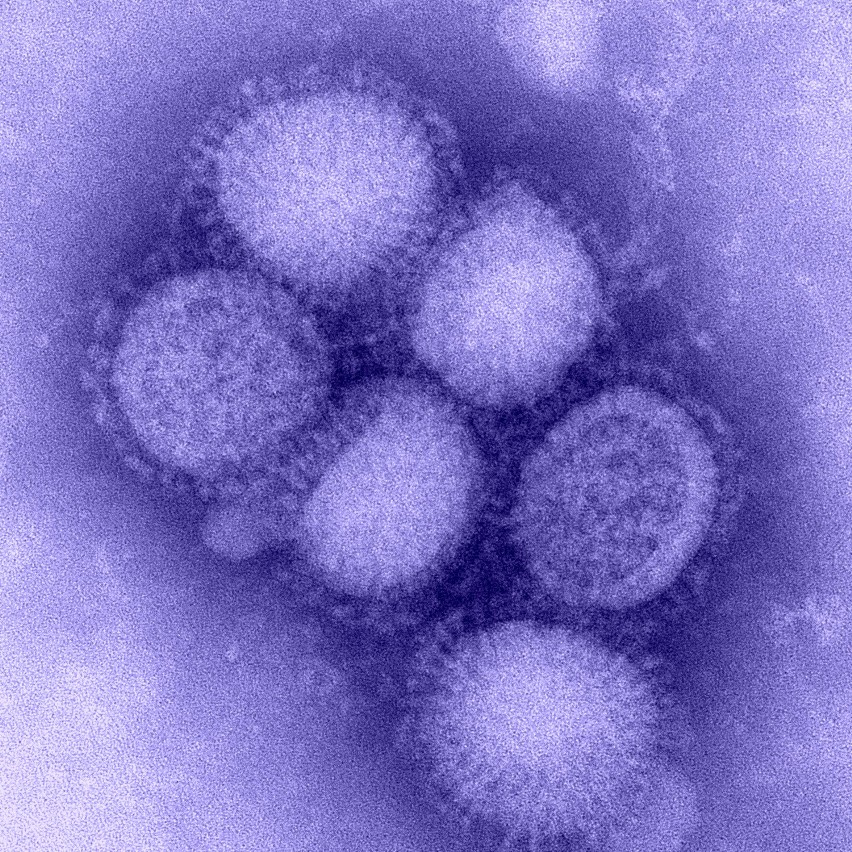 Świńska grypa atakuje w śląskim. Już 39 przypadków zachorowań