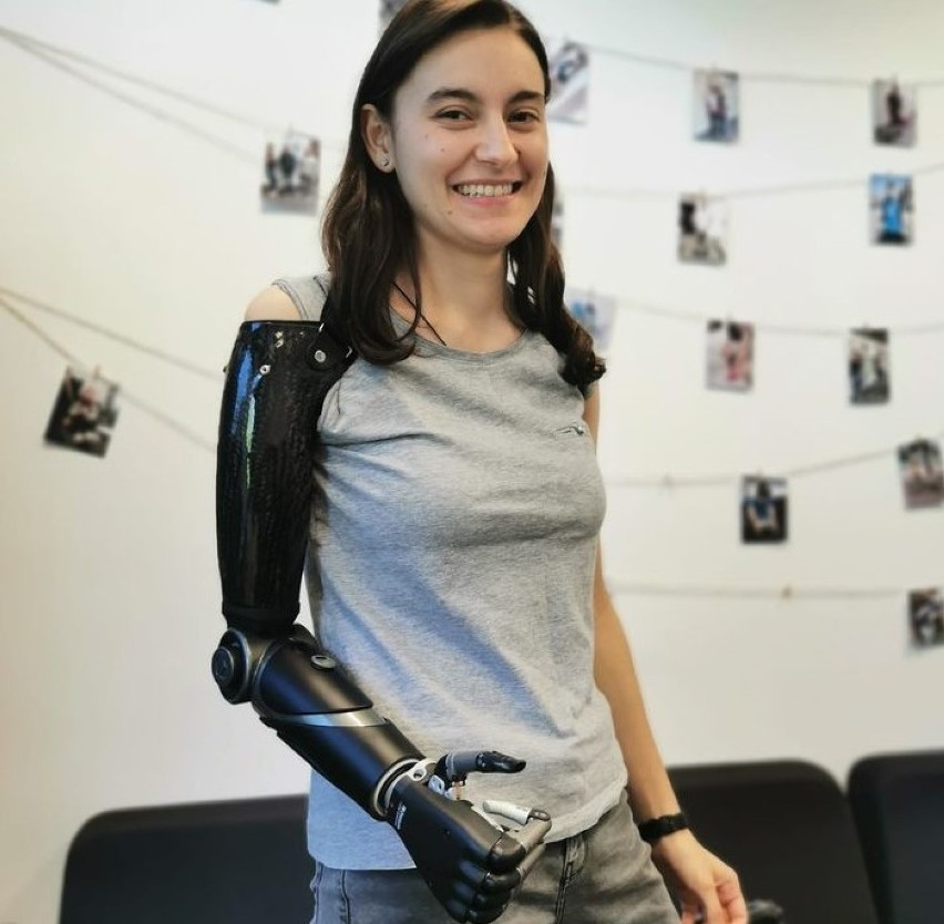 Weronika z protezą bioniczną ILimb Quantum