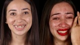 Jak nowe zęby odmieniają ludzi? Brazylijski dentysta naprawia więcej niż uśmiech