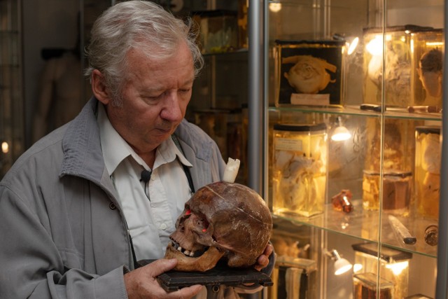 Prof. dr hab. Tadeusz Dobosz na co dzień opiekuje się Muzeum Medycyny Sądowej we Wrocławiu. Na kolejnych slajdach obejrzycie eksponaty, które się w nim znajdują. Możecie na nie przechodzić za pomocą strzałek lub gestów.

UWAGA! Kolejność zdjęć nie jest przypadkowa, najbardziej wstrząsające znajdziecie na końcu galerii - sami zdecydujcie, czy chcecie je zobaczyć.