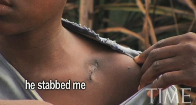 http://www.youtube.com/watch?v=-ip08pjKngI // Rany u jednego z okaleczonych przez LRA dzieci