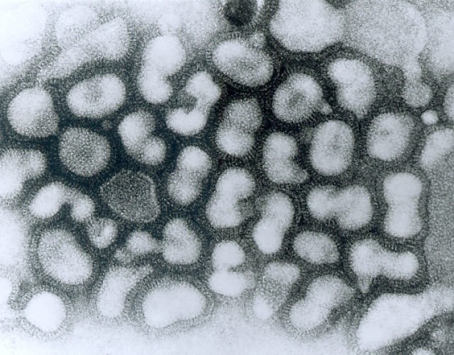 Wirus grypy typu A, wywołujący ptasią grypę. Obraz z transmisyjnego mikroskopu elektronowego. (Źródło: Dr. Erskine Palmer, Biblioteka ilustracji dot. zdrowia publicznego przy Centrum Epidemiologicznym).