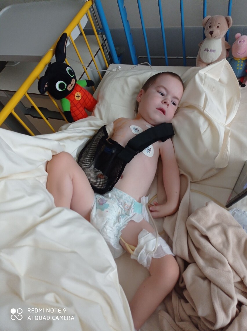 Mały Viktor z Kądzielni zmaga się z ciężką chorobą. Pomóżmy zebrać pieniądze na operację 