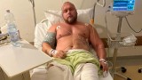 Strongman Maciej Hirsz potrzebuje pomocy - doznał poważnej kontuzji na zawodach