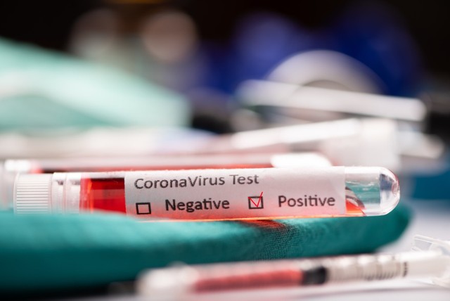 W związku z niepokojącymi informacjami o pojawieniu się koronawirusa w kolejnym Domu Pomocy Społecznej na Pomorzu, władze Sopotu podjęły decyzję o zakupie następnej puli testów dla swoich pracowników medycznych i służb.