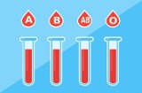Za oddanie krwi można dostać pieniądze? Fakty i mity na temat krwiodawstwa. Dlaczego warto oddawać krew i jak zostać honorowym dawcą krwi?