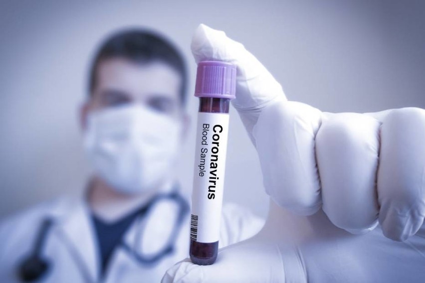 20 816 nowych przypadków zakażenia koronawirusem odnotowano w Polsce w poniedziałkowym raporcie Ministerstwa Zdrowia