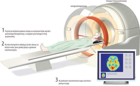 Dr Zbigniew Wygoda z Instytutu Onkologii: PET to przełom w diagnostyce raka.