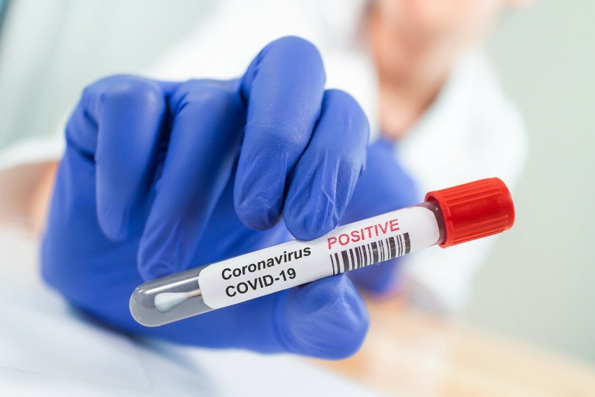 Liczba wykonywanych testów na koronawirusa wzrosła w ciągu...