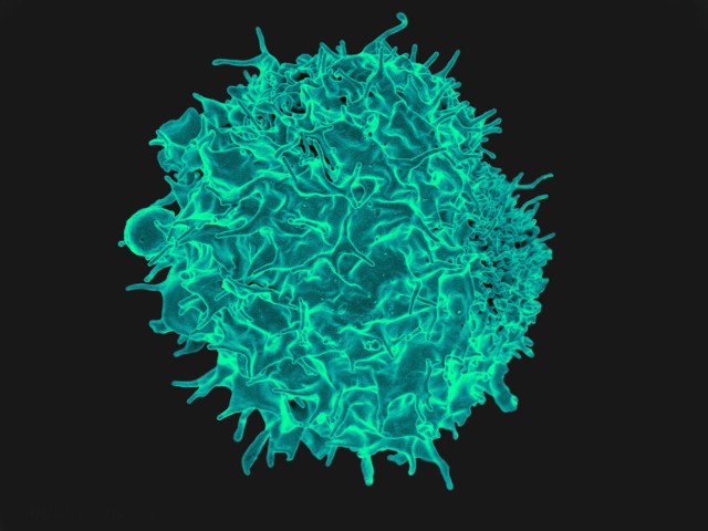 Limfocyt T – kolorowana zdjęcie z elektronowego mikroskopu skaningowego, wykonane przez amerykański Narodowy Instytut Alergii i Chorób Zakaźnych
